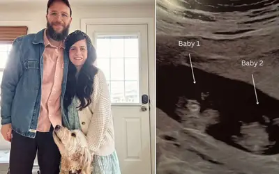 Após abortos espontâneos, casal engravida de gêmeos: 